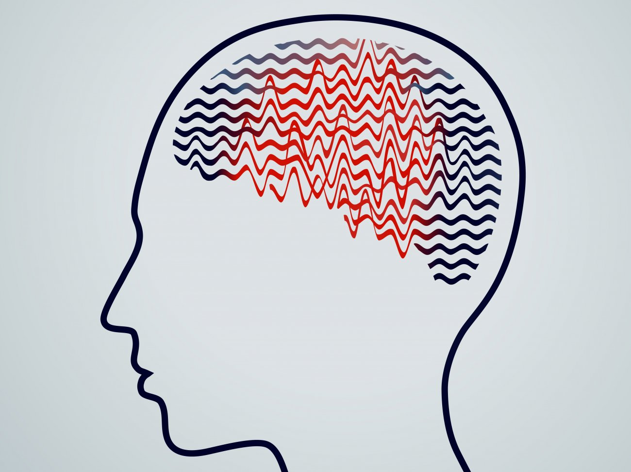 understanding-epilepsy-causes-symptoms-and-treatments-my-press-plus